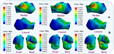 Analysis of stress response distribution in patients with lateral ankle ligament injuries: a study of neural control strategies utilizing predictive computing models